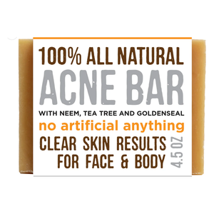 Acne Bar Soap